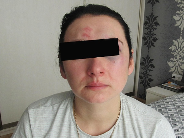 Телеведущая Вардомская избила женщину, не пропустившую ее машину во дворе - фото 